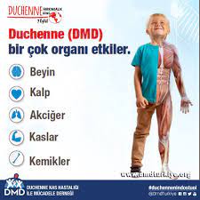 Duchenne Musküler Distrofi (DMD) Hastalığı Nedir?